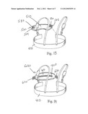 PANNUS SUPPORT ADAPTED FOR SURGICAL PROCEDURES diagram and image