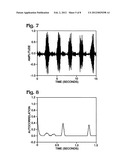 Linear classification method for determining acoustic physiological signal     quality and device for use therein diagram and image