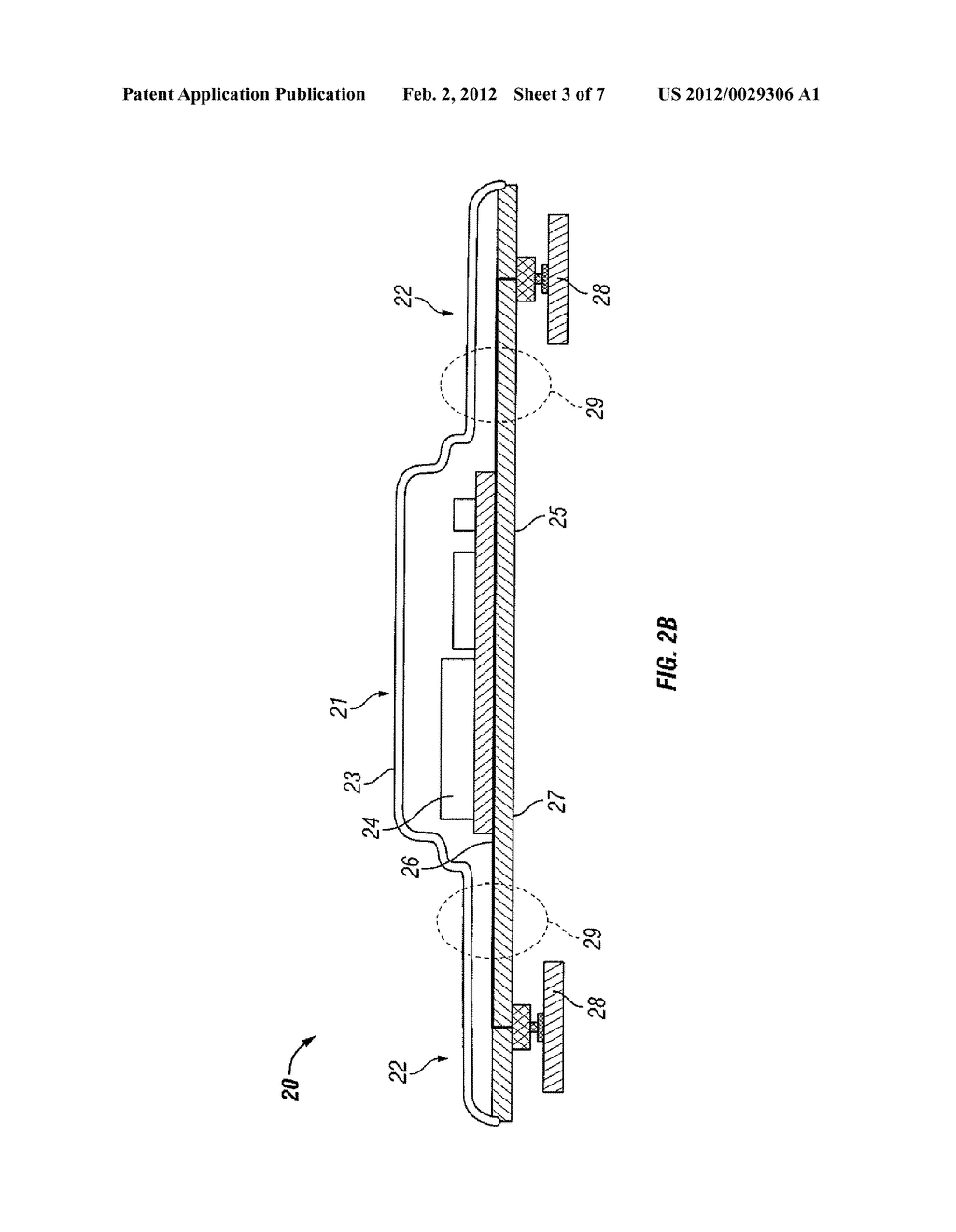 VITAL-SIGNS MONITOR WITH ENCAPSULATION ARRANGEMENT - diagram, schematic, and image 04