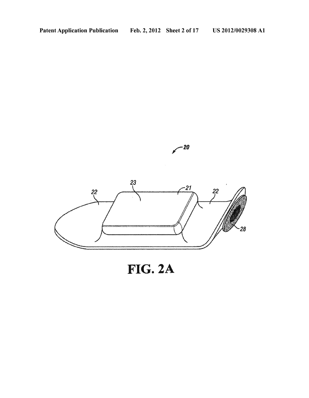 SYSTEM AND METHOD FOR MONITORING BODY TEMPERATURE OF A PERSON - diagram, schematic, and image 03