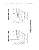 IDENTIFICATION, DIAGNOSIS, AND TREATMENT OF NEUROPATHOLOGIES,     NEUROTOXICITIES, TUMORS, AND BRAIN AND SPINAL CORD INJURIES USING     ELECTRODES WITH MICROVOLTAMMETRY diagram and image