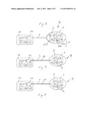 MODULAR INFUSION SET WITH AN INTEGRATED ELECTRICALLY POWERED FUNCTIONAL     COMPONENT diagram and image