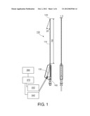 NEEDLE WITH INTEGRATED FIBERS IN THE CUTTING FACETS OF THE BEVEL diagram and image