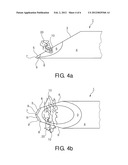 NEEDLE WITH INTEGRATED FIBERS IN THE CUTTING FACETS OF THE BEVEL diagram and image