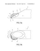 NEEDLE WITH INTEGRATED FIBERS IN THE CUTTING FACETS OF THE BEVEL diagram and image