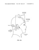 Electrically Evoked Brainstem Response Measurements via Implant Prosthesis diagram and image