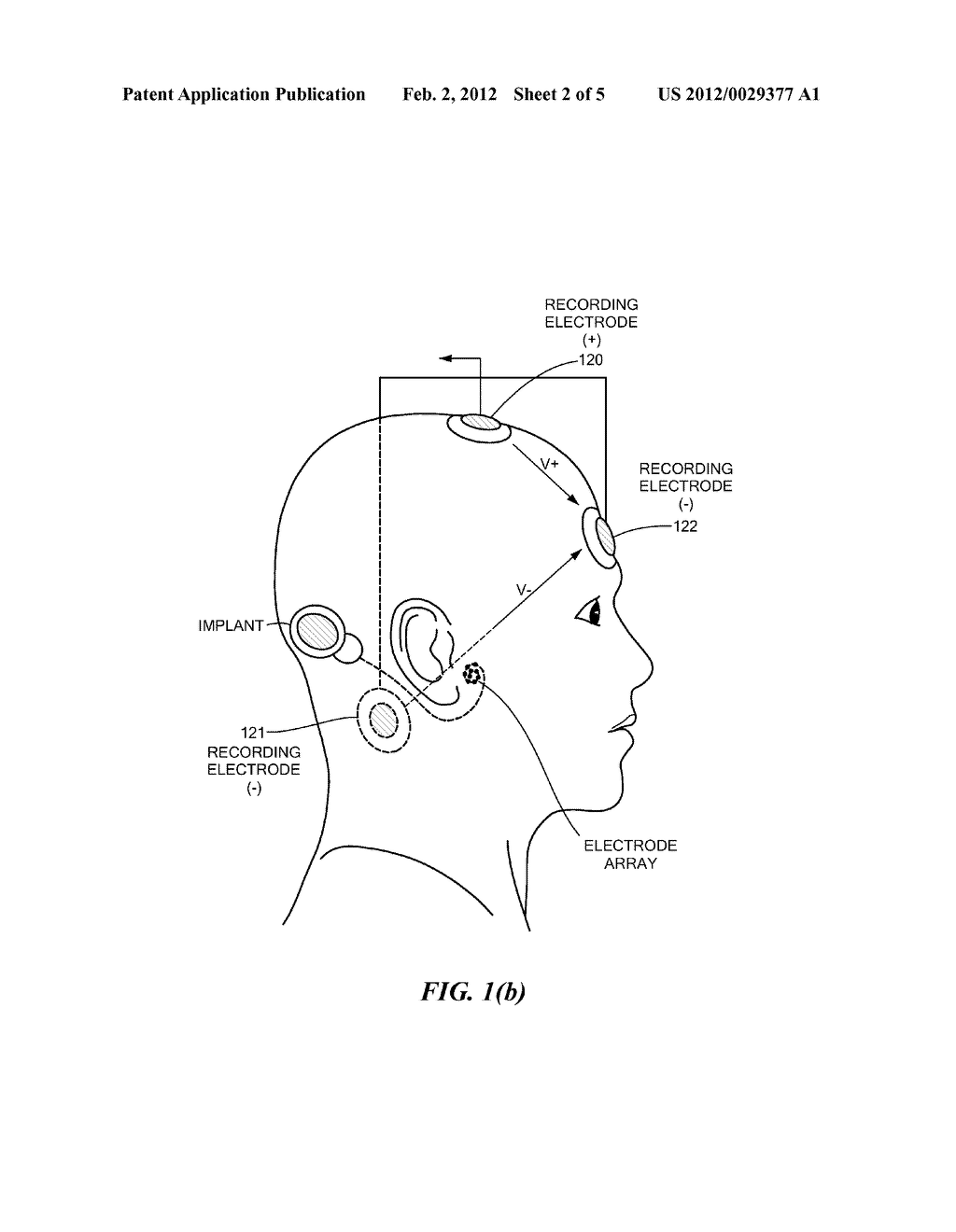 Electrically Evoked Brainstem Response Measurements via Implant Prosthesis - diagram, schematic, and image 03