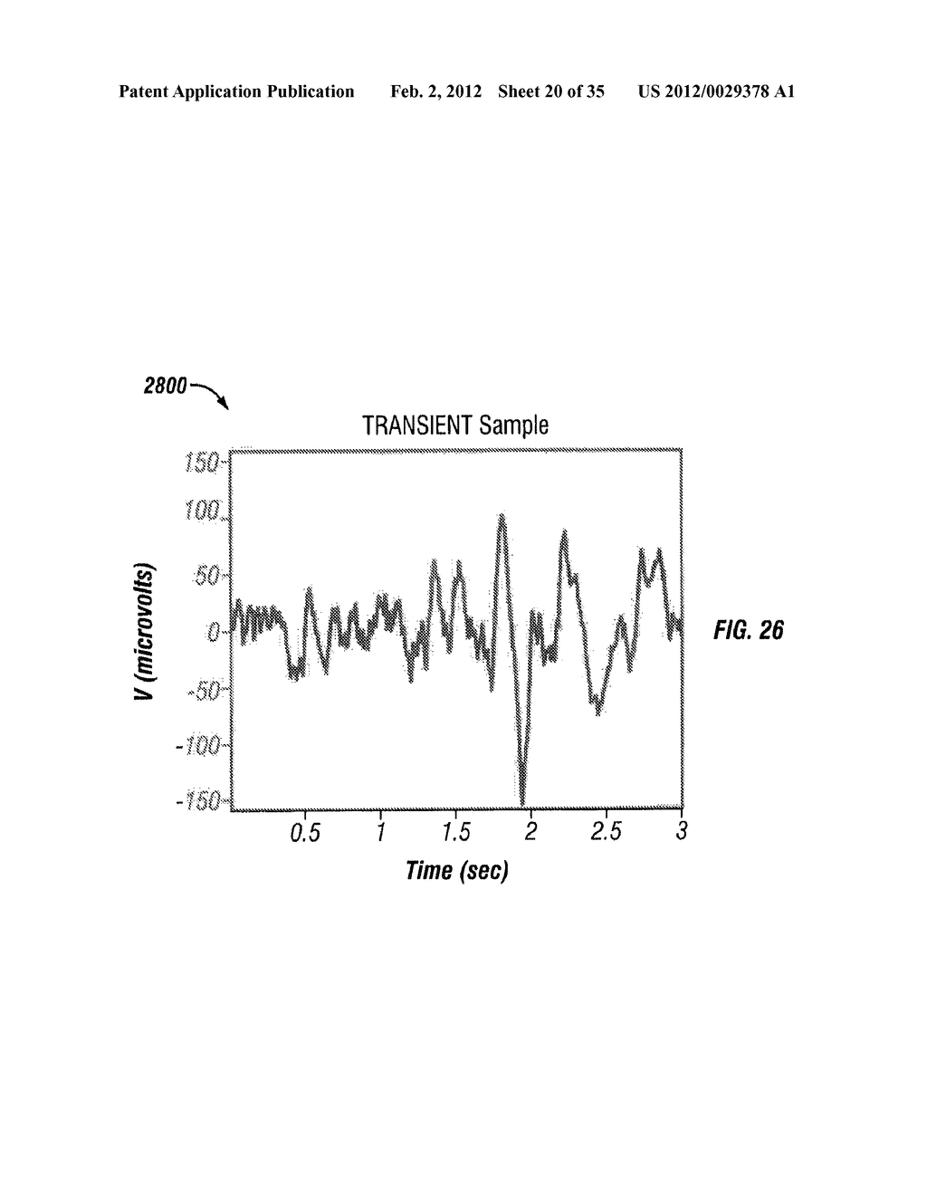 AUTOMATED DETECTION OF SLEEP AND WAKING STATES - diagram, schematic, and image 21