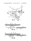 RESTRAINT DEVICE AND METHOD OF USE diagram and image