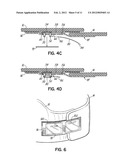 RESTRAINT DEVICE AND METHOD OF USE diagram and image