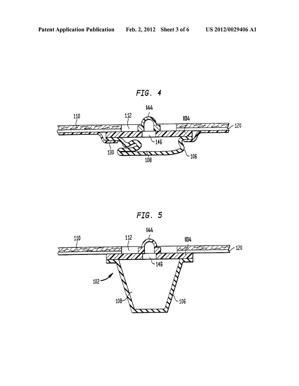 DEVICE AND METHOD FOR COMPRESSING WOUNDS - diagram, schematic, and image 04