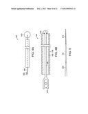 GASTROINTESTINAL IMPLANT WITH DRAWSTRING diagram and image