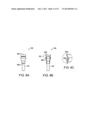 GASTROINTESTINAL IMPLANT WITH DRAWSTRING diagram and image