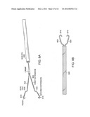 GASTROINTESTINAL IMPLANT WITH DRAWSTRING diagram and image