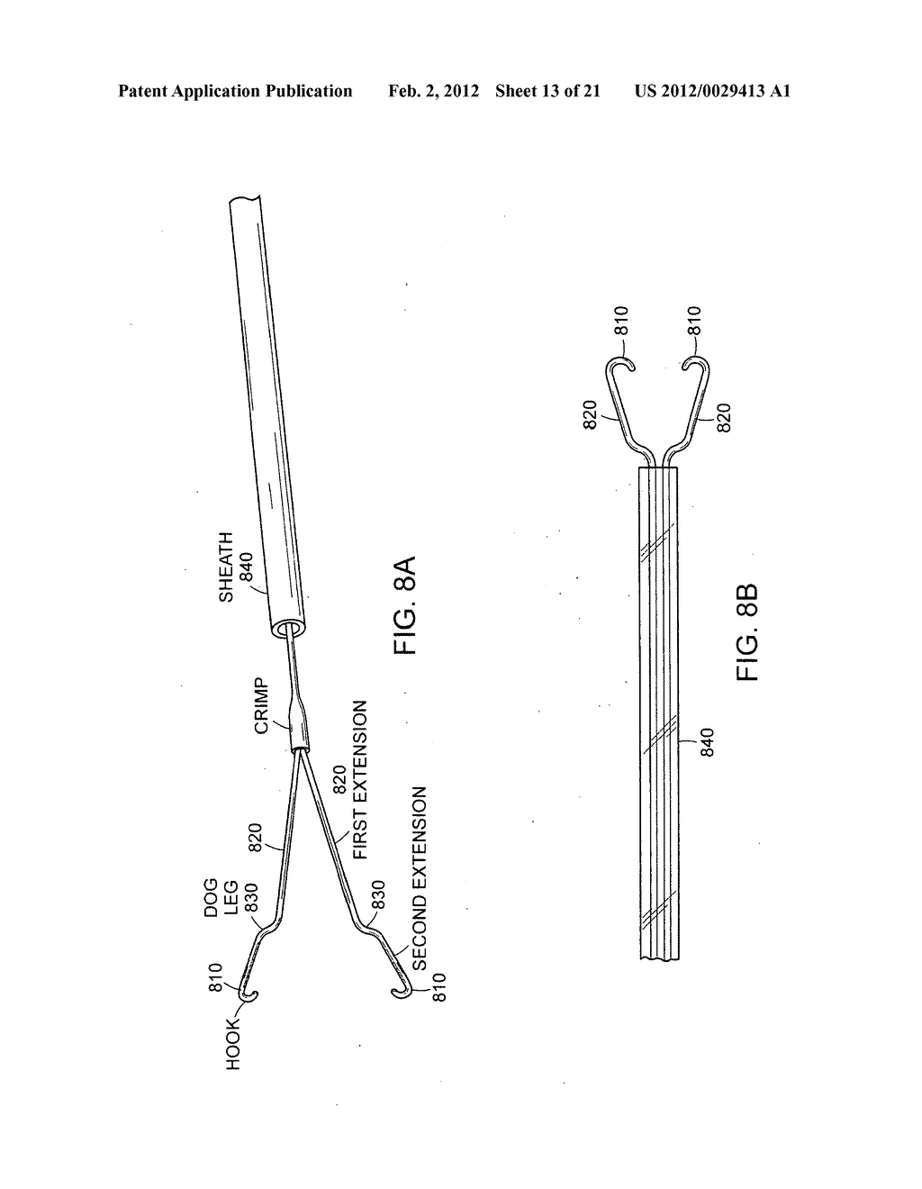 GASTROINTESTINAL IMPLANT WITH DRAWSTRING - diagram, schematic, and image 14