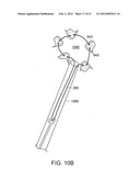 GASTROINTESTINAL IMPLANT WITH DRAWSTRING diagram and image