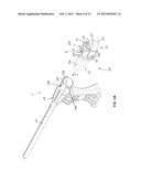 MEDICAL DELIVERY SYSTEMS AND APPARATUS diagram and image