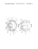 MEDICAL DELIVERY SYSTEMS AND APPARATUS diagram and image