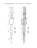 STERILE DISPOSABLE REMOTE PNEUMATIC ACTUATORS diagram and image