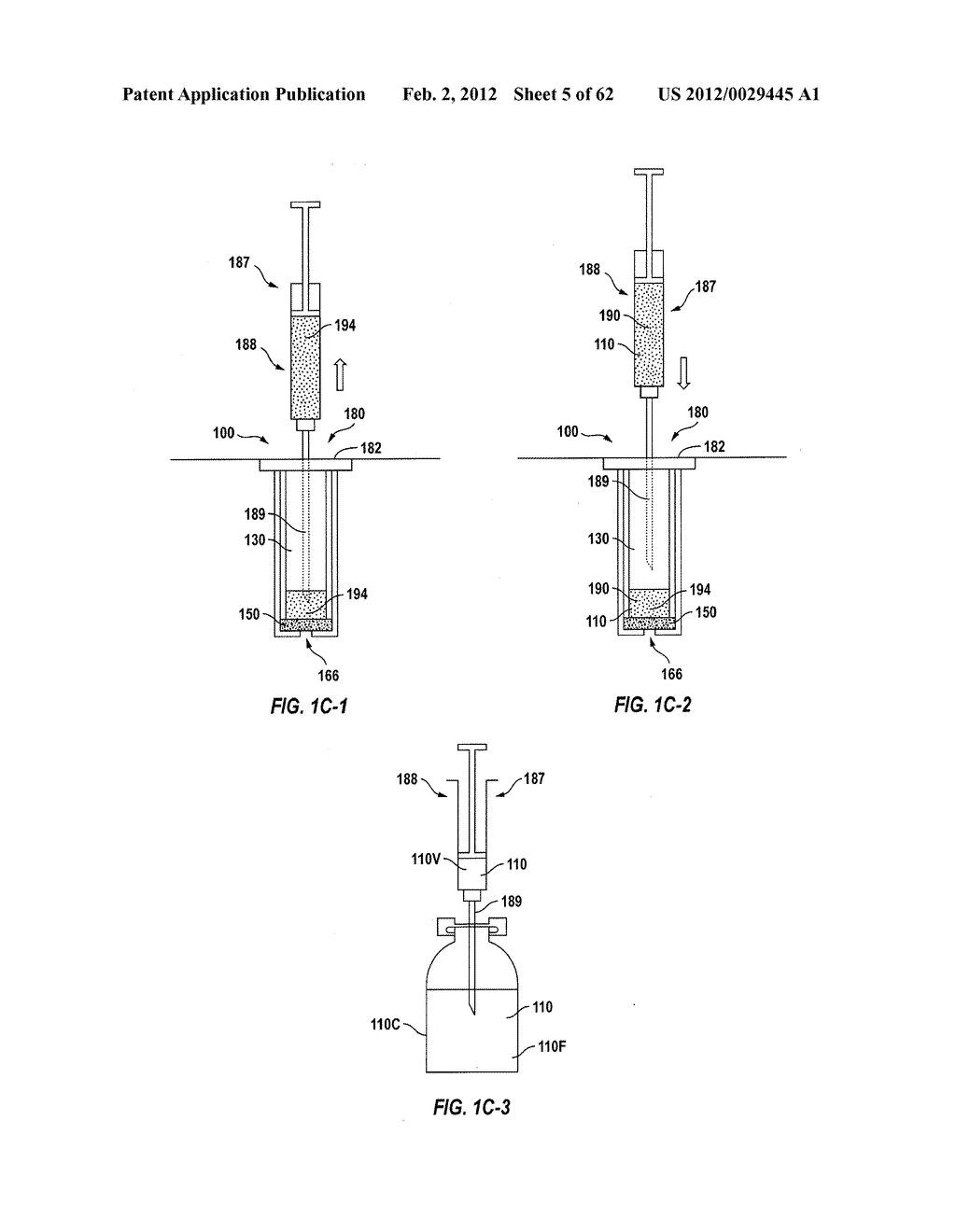 POSTERIOR SEGMENT DRUG DELIVERY - diagram, schematic, and image 06