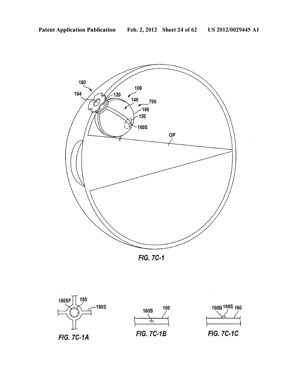 POSTERIOR SEGMENT DRUG DELIVERY - diagram, schematic, and image 25