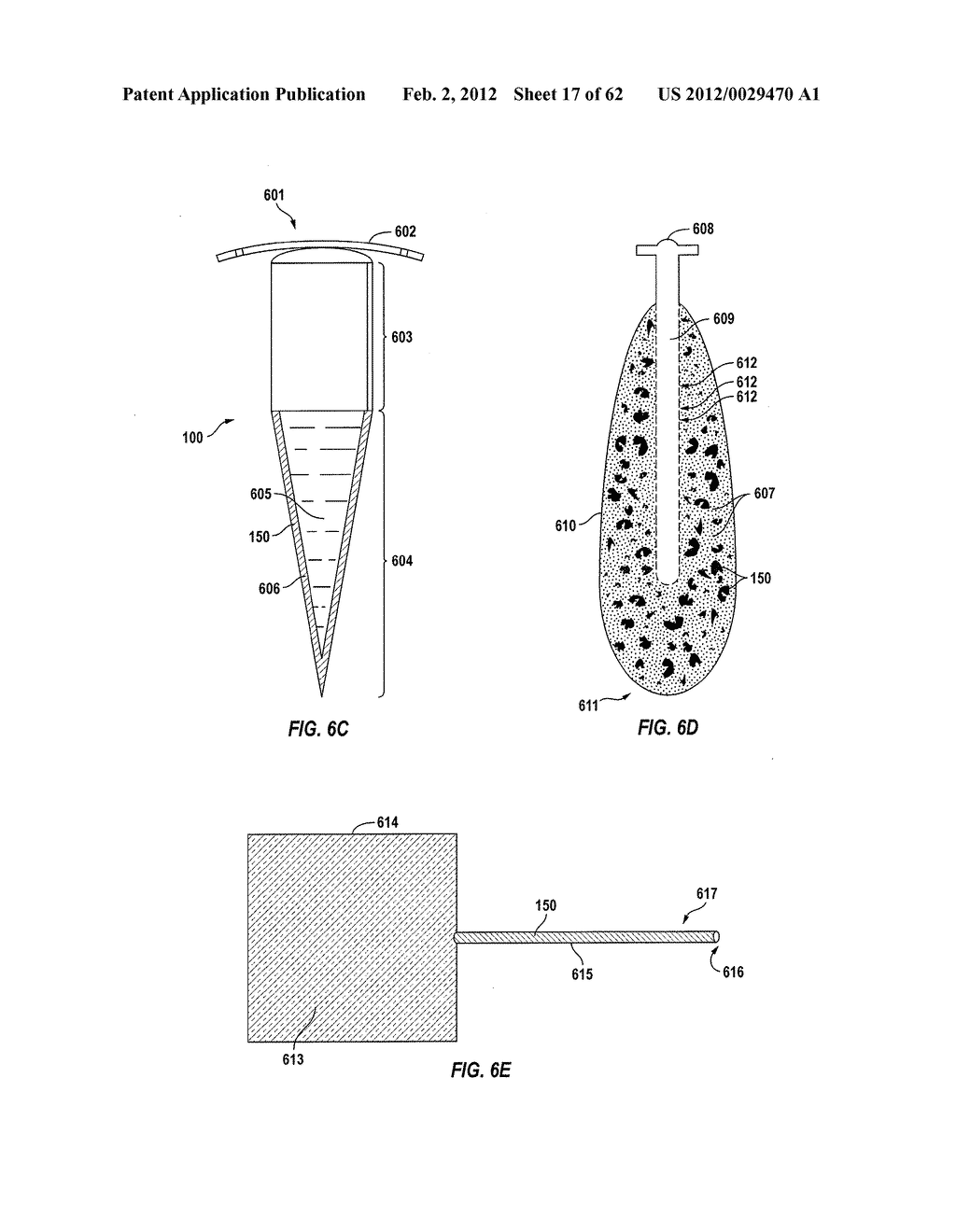 POSTERIOR SEGMENT DRUG DELIVERY - diagram, schematic, and image 18