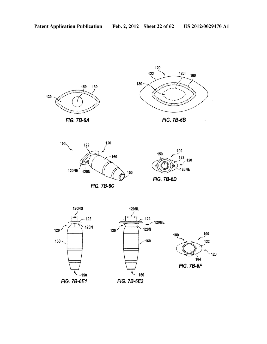 POSTERIOR SEGMENT DRUG DELIVERY - diagram, schematic, and image 23