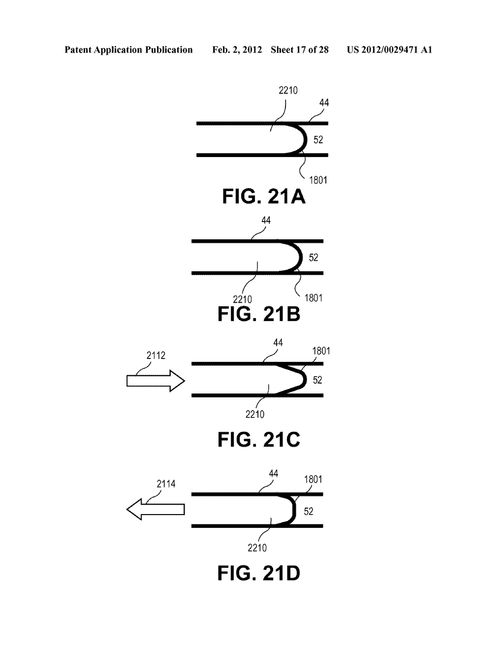 TWO CHAMBER SYRINGE WITH LOCKING MECHANISM - diagram, schematic, and image 18