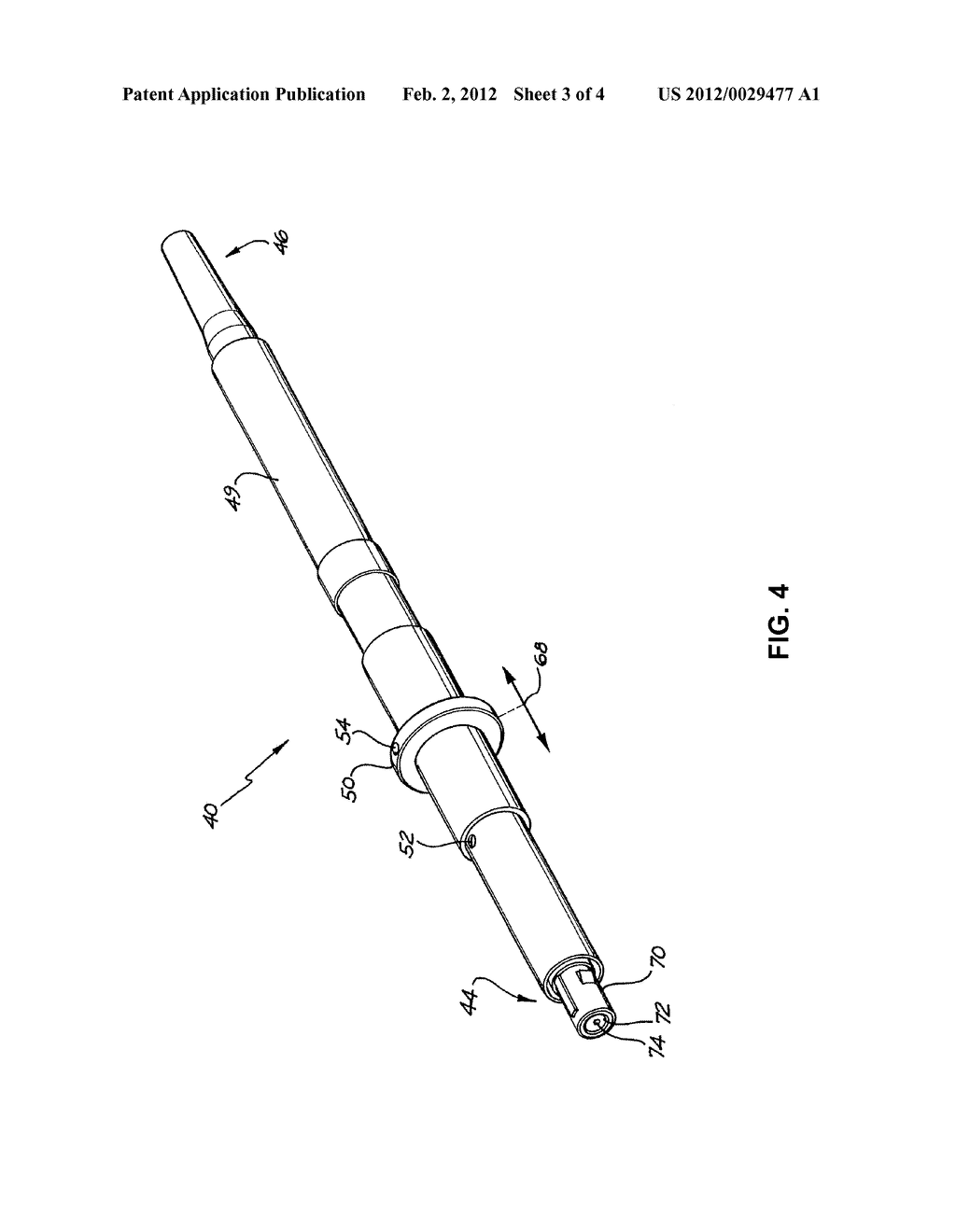 MODULAR CATHETER - diagram, schematic, and image 04