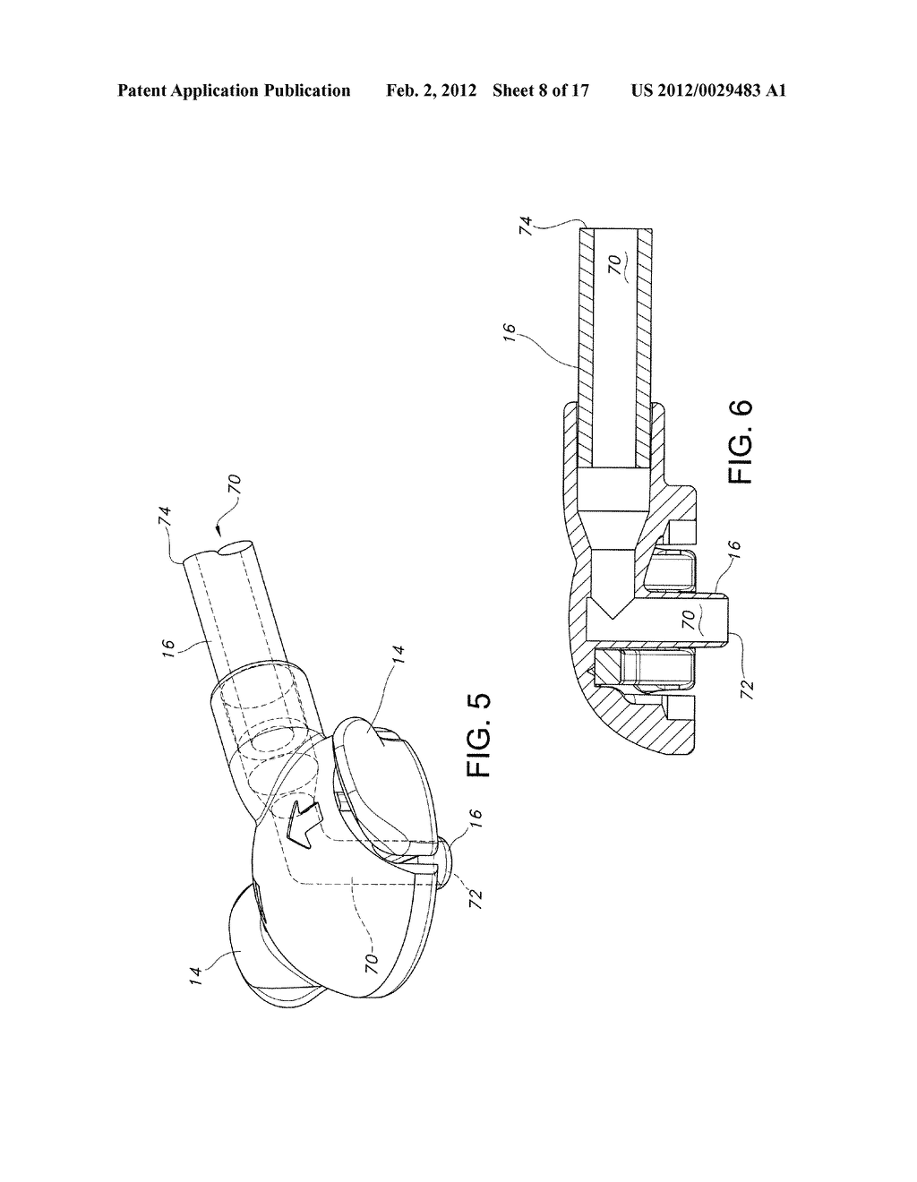 Enteral Feeding Extension Set Connector - diagram, schematic, and image 09