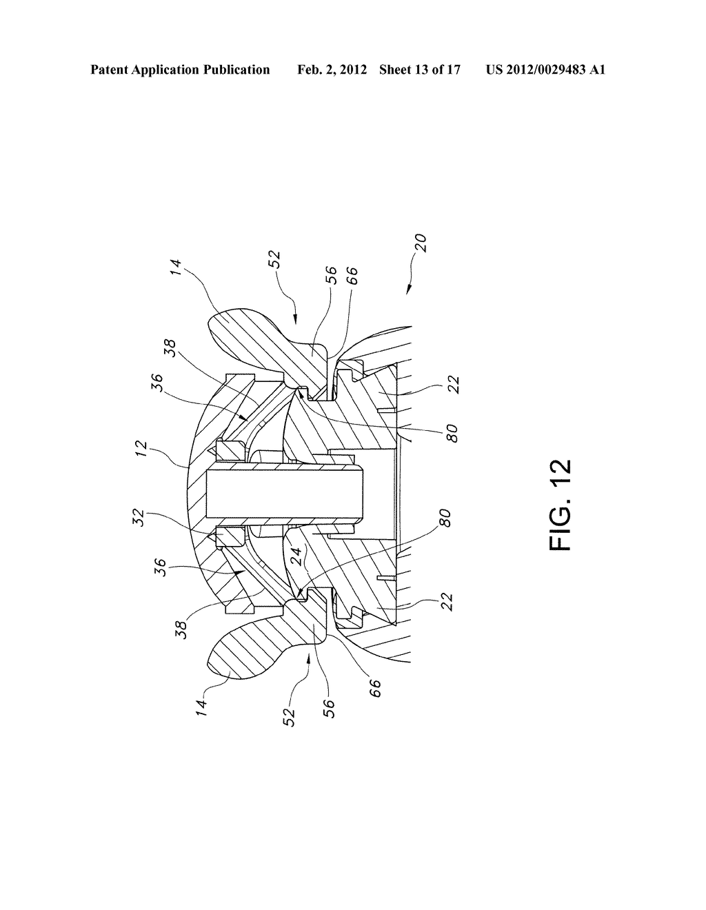 Enteral Feeding Extension Set Connector - diagram, schematic, and image 14