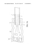 ANIMAL FECES SUCTION APPARATUS diagram and image