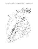 REDUCED-PRESSURE, COMPRESSION SYSTEMS AND APPARATUSES FOR USE ON A CURVED     BODY PART diagram and image