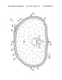 REDUCED-PRESSURE, COMPRESSION SYSTEMS AND APPARATUSES FOR USE ON A CURVED     BODY PART diagram and image