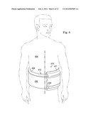 REDUCED-PRESSURE, COMPRESSION SYSTEMS AND APPARATUSES FOR USE ON A CURVED     BODY PART diagram and image