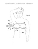 REDUCED-PRESSURE, COMPRESSION SYSTEMS AND APPARATUSES FOR USE ON A CURVED     BODY PART diagram and image