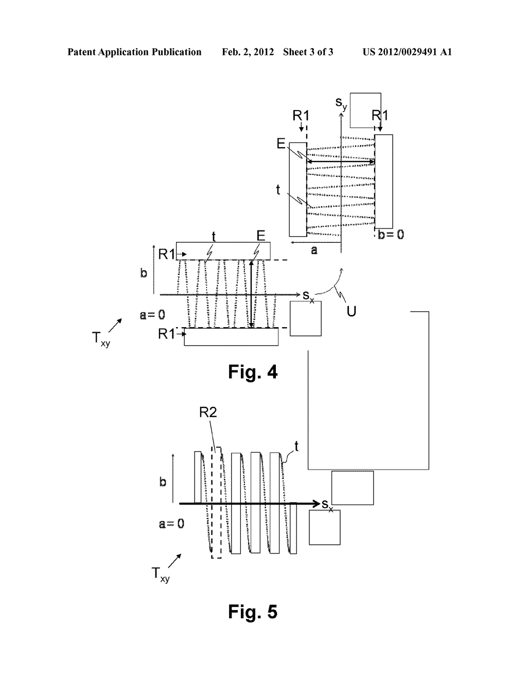 DEVICE FOR PROCESSING EYE TISSUE BY A MEANS OF FEMTOSECOND LASER PULSES - diagram, schematic, and image 04