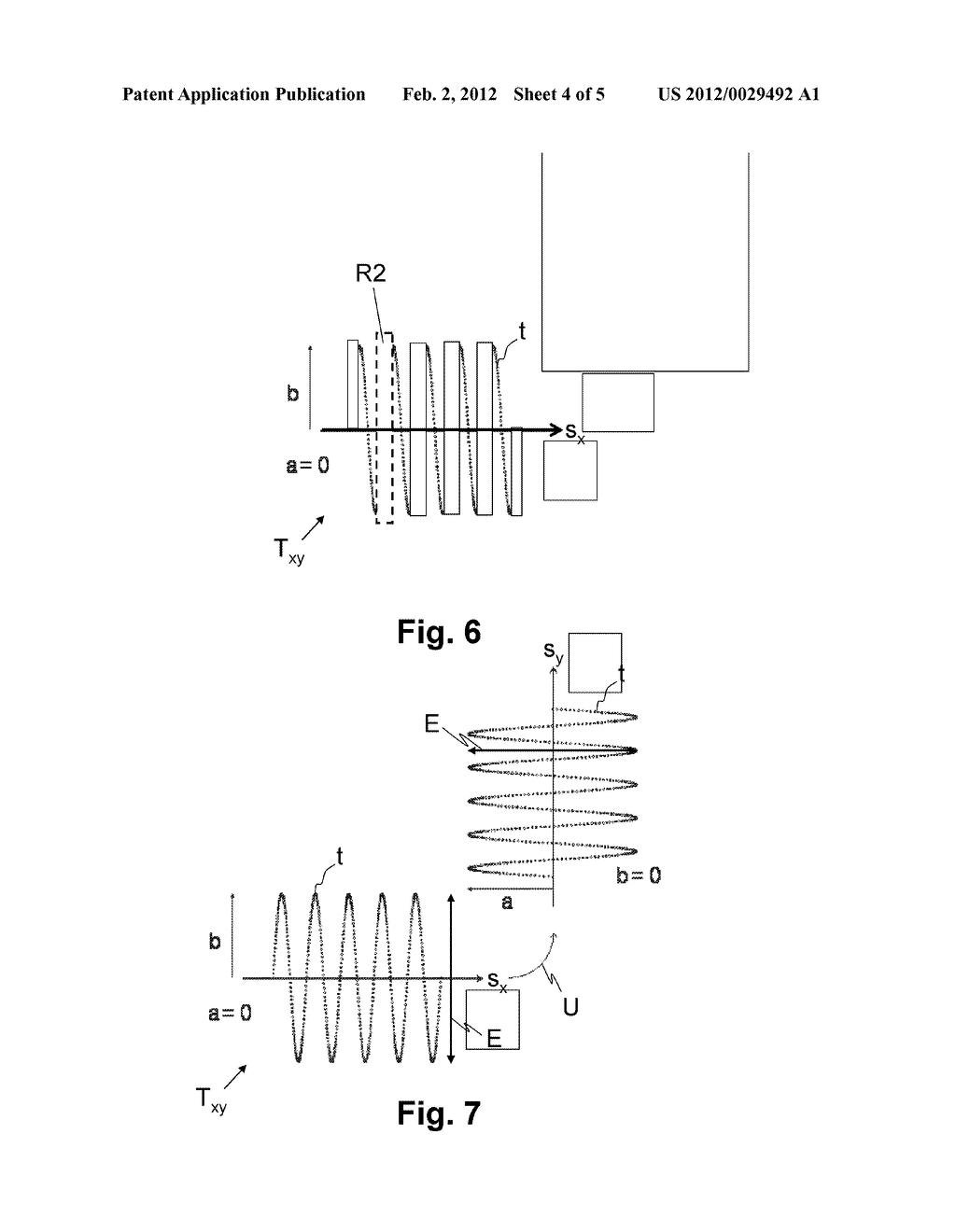 DEVICE FOR PROCESSING EYE TISSUE BY MEANS OF FEMTOSECOND LASER PULSES - diagram, schematic, and image 05