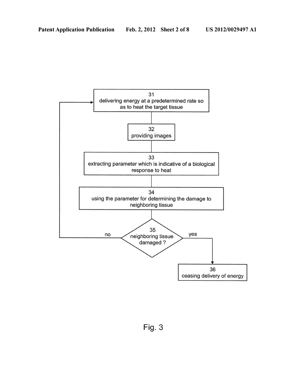Method and System for Monitoring Ablation of Tissues - diagram, schematic, and image 03