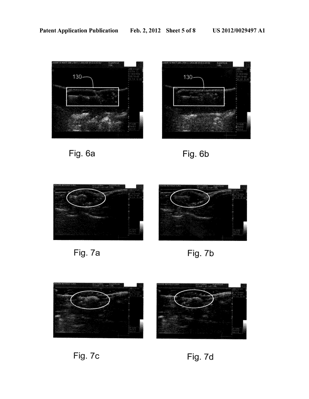 Method and System for Monitoring Ablation of Tissues - diagram, schematic, and image 06