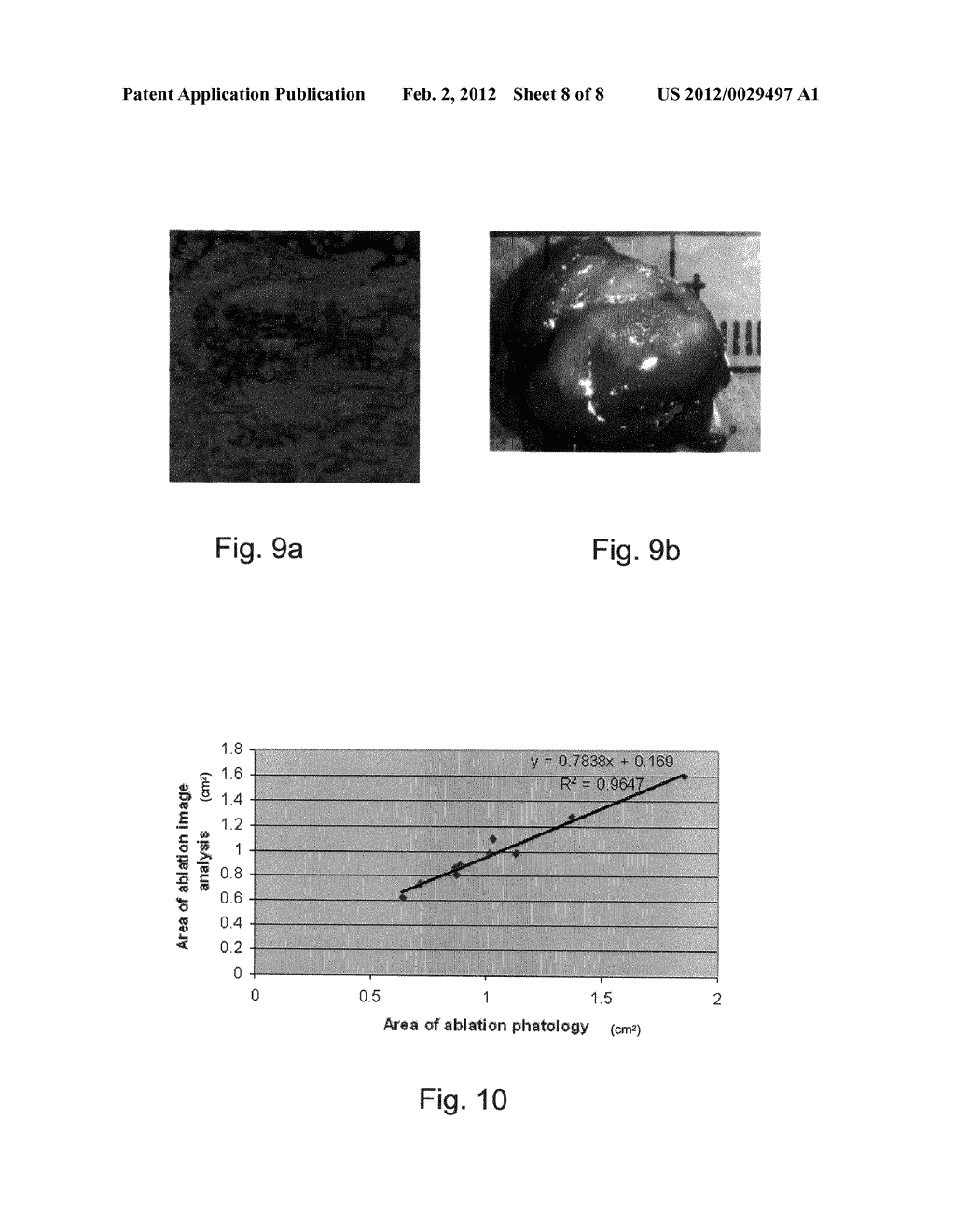 Method and System for Monitoring Ablation of Tissues - diagram, schematic, and image 09