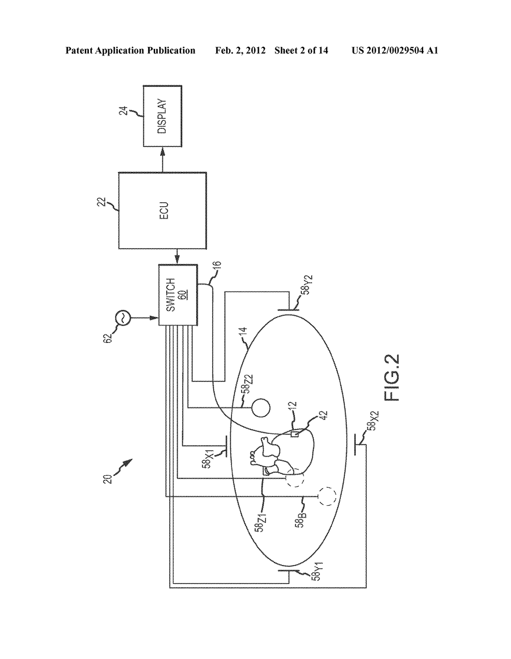 SYSTEM AND METHOD FOR PRESENTING INFORMATION REPRESENTATIVE OF LESION     FORMATION IN TISSUE DURING AN ABLATION PROCEDURE - diagram, schematic, and image 03