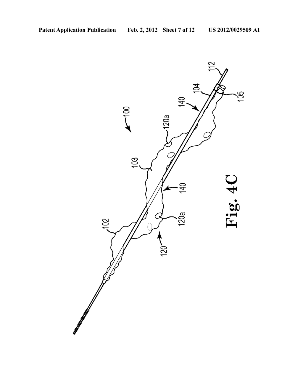 Spiral Balloon Catheter for Renal Nerve Ablation - diagram, schematic, and image 08