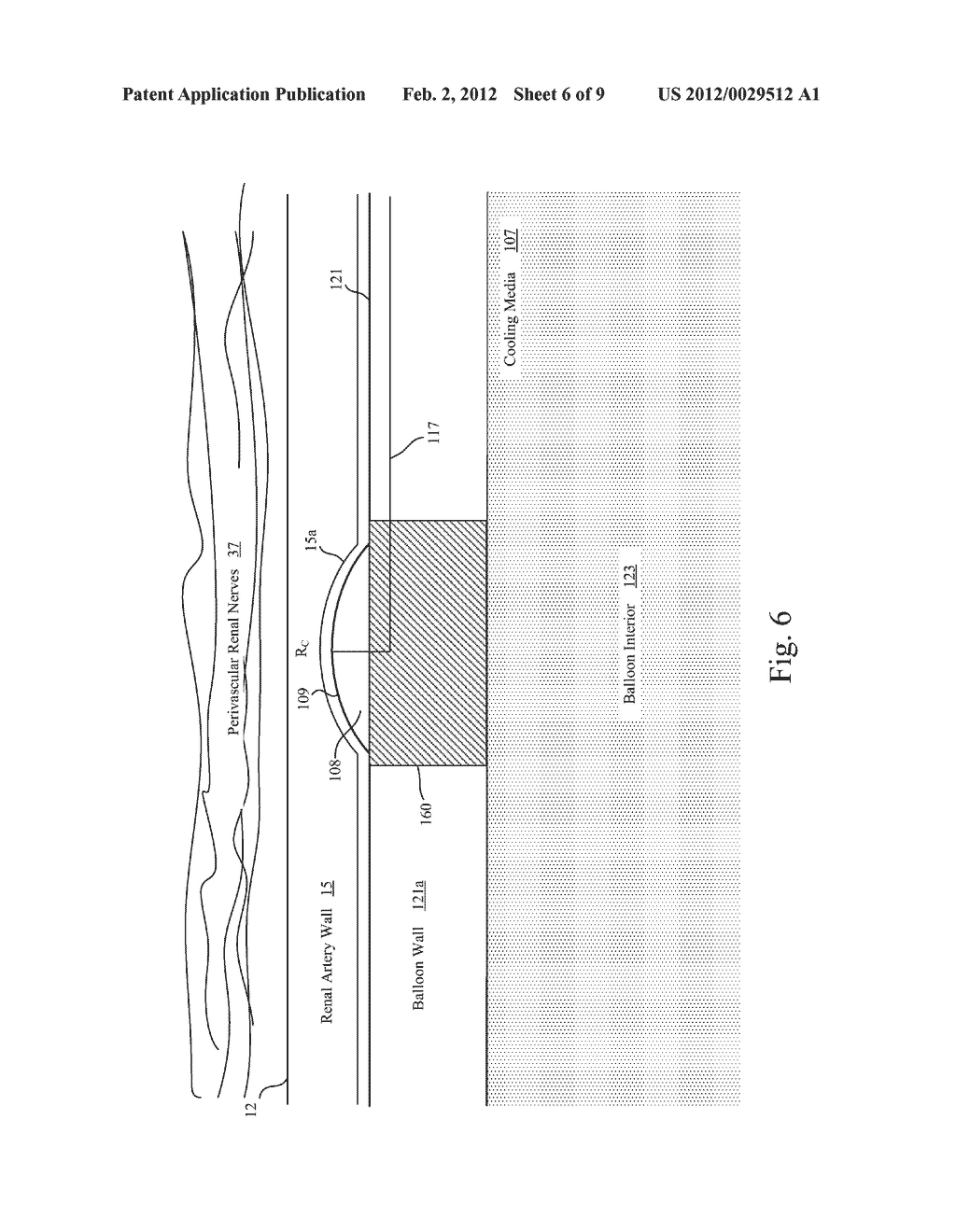 BALLOON WITH SURFACE ELECTRODES AND INTEGRAL COOLING FOR RENAL NERVE     ABLATION - diagram, schematic, and image 07