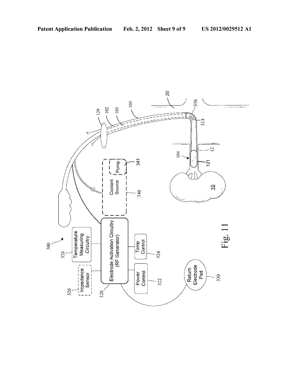 BALLOON WITH SURFACE ELECTRODES AND INTEGRAL COOLING FOR RENAL NERVE     ABLATION - diagram, schematic, and image 10