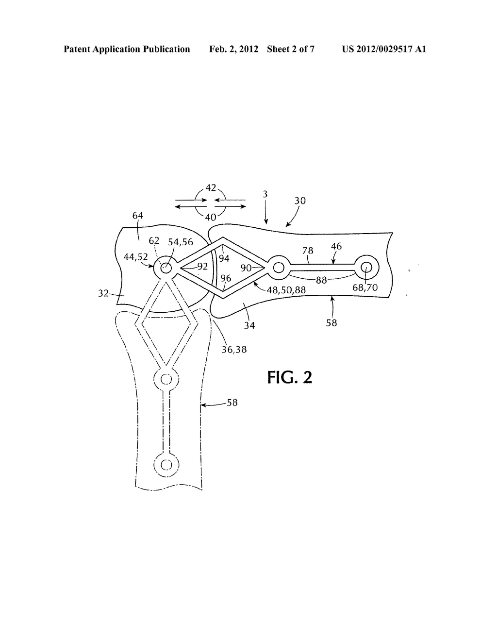 Orthopedic external fixator and method of use - diagram, schematic, and image 03