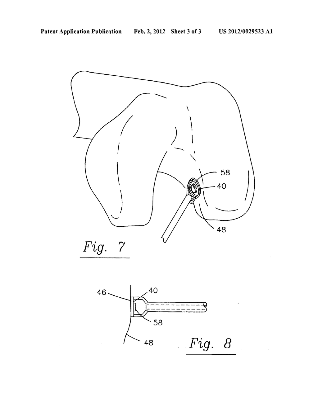 Guide pin positioner - diagram, schematic, and image 04