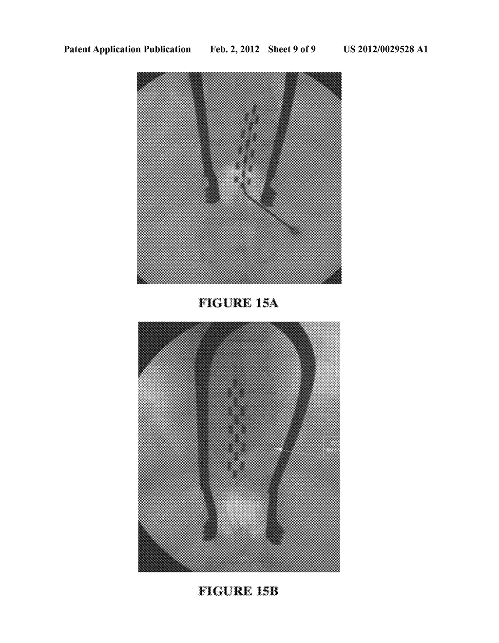 SPINAL CORD STIMULATION SYSTEM AND METHODS OF USING SAME - diagram, schematic, and image 10