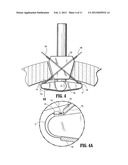 Wound Closure Device Including Mesh Barrier diagram and image