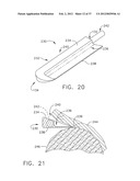 ULTRASONIC SURGICAL INSTRUMENT BLADES diagram and image